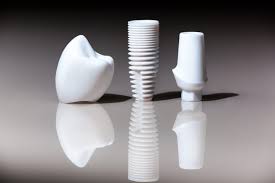 Ceramic Implants and Their Advantages