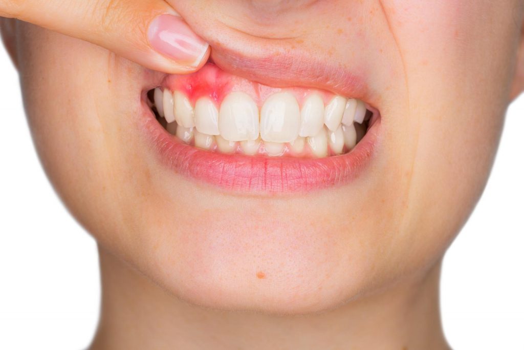 Healthy Gums are Better for Your Heart